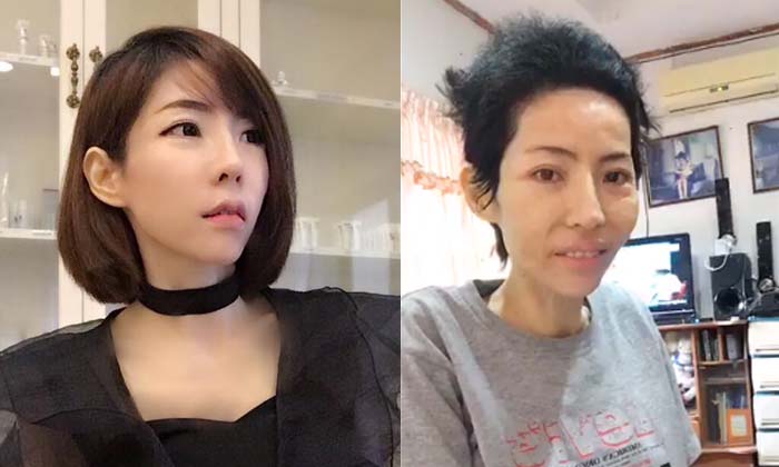 "มะนาว แม็กซิม" ป่วยมะเร็งปากมดลูกระยะสุดท้าย ล่าสุดเดินไม่ได้แล้ว