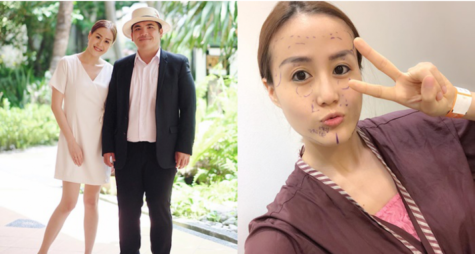 "แจ็ค แฟนฉัน" ให้กำลังใจแฟน ศัลยกรรมครั้งแรกในชีวิต