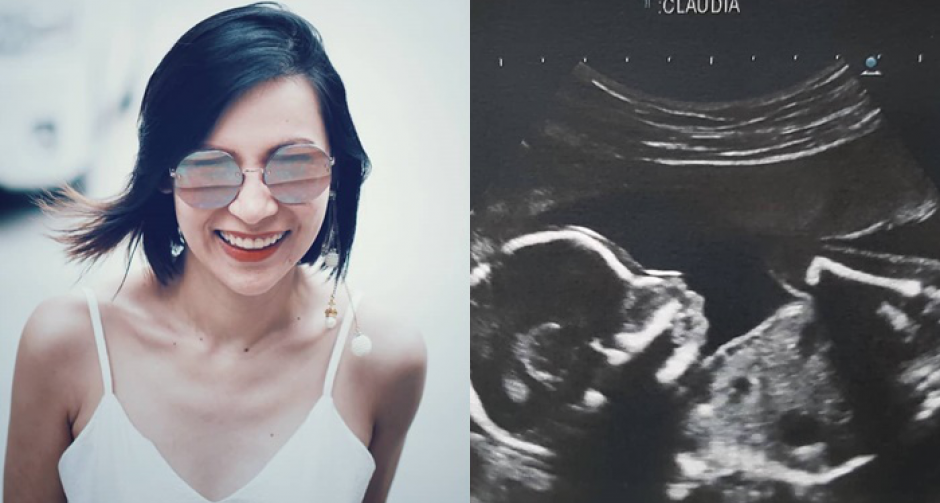 "ต้นหอม ศกุนตลา" โพสต์ภาพอัลตราซาวด์ แฟนๆ แห่แสดงความยินดี