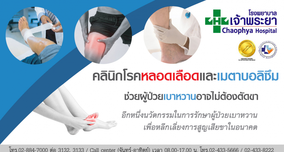 โรงพยาบาลเจ้าพระยาพร้อมช่วยดูแลผู้ป่วยเบาหวานอาจไม่ต้องตัดขา