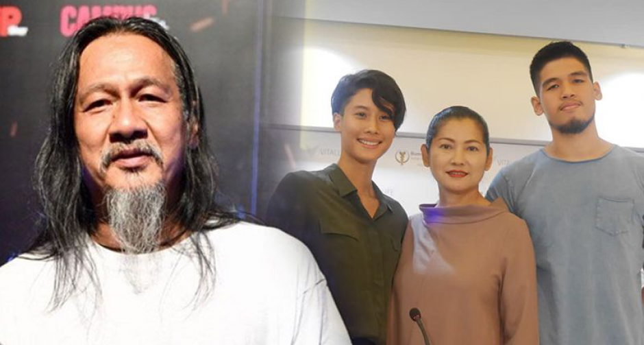 "อ๊อฟ พงษ์พัฒน์" อาการดีขึ้นมาก ปลอดภัยหายห่วงรอกายภาพฟื้นฟูร่างกาย