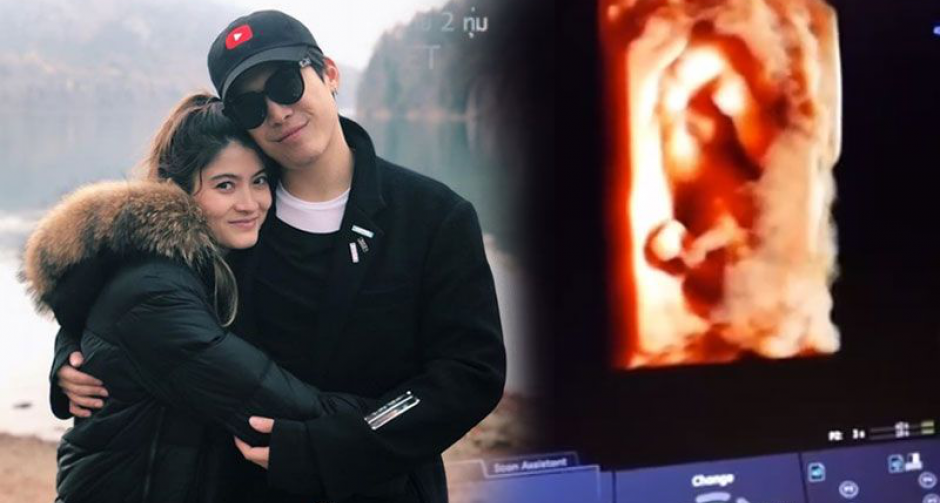 "มาร์กี้-ป๊อก" ยิ้มแก้มปริได้แฝดชาย-หญิง