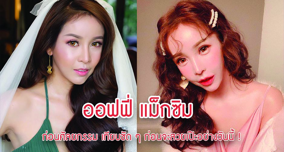 ออฟฟี่ แม็กซิม ก่อนศัลยกรรม เทียบชัด ๆ ก่อนจะสวยเป๊ะอย่างวันนี้ !