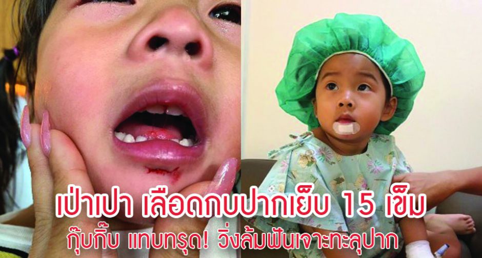 กุ๊บกิ๊บ แทบทรุด! เป่าเปา เลือดกบปากเย็บ 15เข็ม ซิ่งเข้ากทม.ส่งรพ.ด่วน