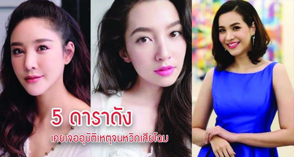 5 ดาราดัง เคยเจออุบัติเหตุจนหวิดเสียโฉม